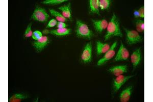 HeLa cells grown in tissue culture and stained with HMG1 / HMGB1 antibody (red), chicken polyclonal antibody to Vimentin (green) and DNA (blue). (HMGB1 抗体)