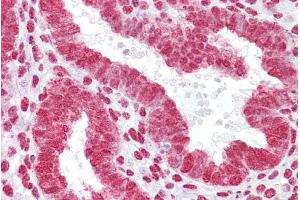 Immunohistochemistry with Uterus tissue at an antibody concentration of 5µg/ml using anti-HOXA11 antibody (ARP37064_P050) (Homeobox A11 抗体  (C-Term))