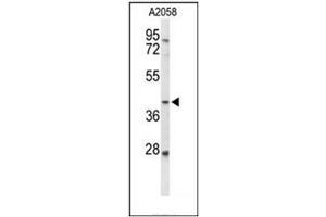 Western blot analysis of FUT3 Antibody (C-term) in A2058 cell line lysates (35ug/lane). (FUT3 抗体  (C-Term))