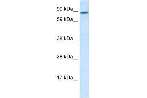 WB Suggested Anti-TCF4 Antibody Titration:  0. (TCF4 抗体  (N-Term))