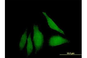 Immunofluorescence of purified MaxPab antibody to WDSUB1 on HeLa cell. (WDSUB1 抗体  (AA 1-384))