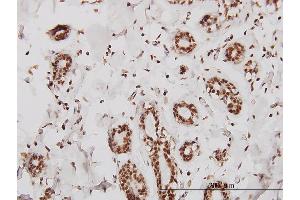Immunoperoxidase of monoclonal antibody to SMARCD2 on formalin-fixed paraffin-embedded human breast.