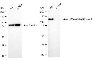 Western blotting analysis using NIMA related kinase 9 antibody (ABIN7799601).