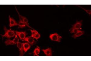 ABIN6274807 staining HuvEc by IF/ICC. (ACOT8 抗体  (Internal Region))