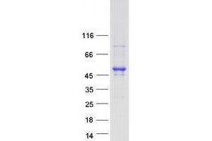 Western Blotting (WB) image for CDC42 Effector Protein (Rho GTPase Binding) 4 (CDC42EP4) protein (Myc-DYKDDDDK Tag) (ABIN2713842)