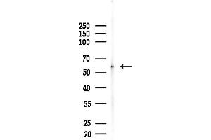 anti-Cholinergic Receptor, Nicotinic, gamma (CHRNG) (N-Term) antibody
