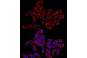Confocal immunofluorescence analysis of HeLa cells using RRBP1 Polyclonal Antibody (ABIN6132872, ABIN6147259, ABIN6147260 and ABIN6215844) at dilution of 1:100. (RRBP1 抗体  (AA 1-140))