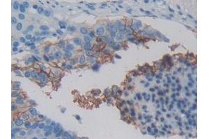 Immunohistochemistry (IHC) image for anti-Met Proto-Oncogene (MET) (AA 1092-1379) antibody (ABIN7434734)