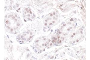 anti-Guanine Nucleotide Binding Protein-Like 3 (Nucleolar) (GNL3) (C-Term) antibody