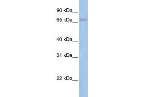 WB Suggested Anti-MAP3K2  Antibody Titration: 0. (MAP3K2 抗体  (N-Term))