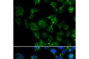 Immunofluorescence analysis of HeLa cells using MAPRE2 Polyclonal Antibody (MAPRE2 抗体)