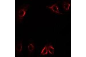 Immunofluorescent analysis of Axin-2 staining in U2OS cells. (AXIN2 抗体)
