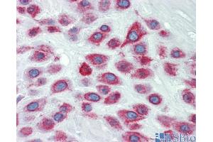 Human Placenta (LIMD1 抗体  (N-Term))