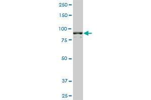 AMPD2 monoclonal antibody (M01), clone 2F5. (AMPD2 抗体  (AA 86-185))