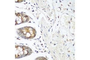 Immunohistochemistry of paraffin-embedded human colon using VEGFR3/FLT4 antibody (ABIN6130780, ABIN6140699, ABIN6140702 and ABIN6221242) at dilution of 1:200 (40x lens). (FLT4 抗体  (AA 1174-1363))