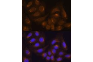 Immunofluorescence analysis of NIH/3T3 cells using Caspase-9 antibody (ABIN6131534, ABIN6137975, ABIN6137977 and ABIN6213766) at dilution of 1:100. (Caspase 9 抗体  (AA 1-98))