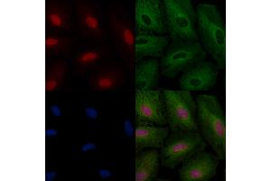 ABIN6264705 and ABIN6266630 staining  cells by IF/ICC. (Retinoic Acid Receptor beta 抗体  (Internal Region))