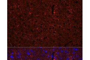 Immunofluorescence analysis of Mouse brain using GAD2 Polyclonal Antibody at dilution of 1:100 (40x lens). (GAD65 抗体)