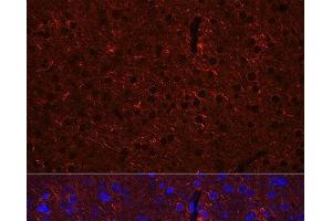 Immunofluorescence analysis of Mouse brain using GAD2 Polyclonal Antibody at dilution of 1:100 (40x lens). (GAD65 抗体)