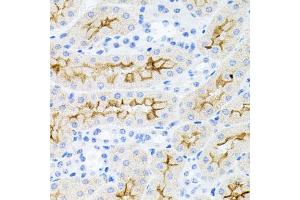 Immunohistochemistry of paraffin-embedded mouse kidney using IL17A antibody (ABIN6290529) at dilution of 1:100 (40x lens). (Interleukin 17a 抗体)
