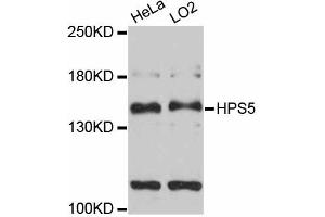 Western blot analysis of extracts of various cell lines, using HPS5 antibody (ABIN5997922) at 1:3000 dilution. (HPS5 抗体)