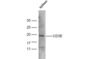 Mouse spleen lysate probed with Anti-CD3E Polyclonal Antibody, Unconjugated  at 1:5000 for 90 min at 37˚C. (CD3 epsilon 抗体  (AA 23-120))