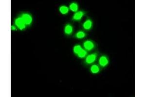 Image no. 1 for anti-Checkpoint Kinase 2 (CHEK2) antibody (ABIN1497495) (CHEK2 抗体)