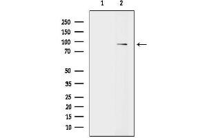 anti-Vav 1 Oncogene (VAV1) (N-Term) antibody