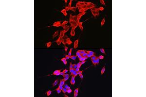 Immunofluorescence analysis of SH-SY5Y cells using α-Synuclein Rabbit pAb (ABIN6129177, ABIN6148190, ABIN6148192 and ABIN6223046) at dilution of 1:100 (40x lens). (SNCA 抗体  (AA 61-140))