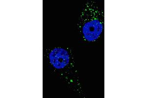 Fluorescent image of  cells stained with UVRAG (C-term) antibody. (UVRAG 抗体  (C-Term))