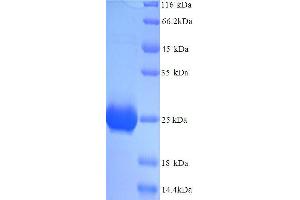 SDS-PAGE (SDS) image for Prolactin (PRL) (AA 31-229), (full length) protein (His tag) (ABIN7478995)