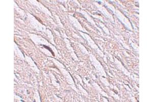 Immunohistochemical staining of human brain cells with SLC39A2 polyclonal antibody  at 2. (ZIP2 抗体  (N-Term))