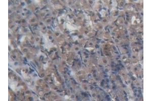 Detection of PDP2 in Rat Stomach Tissue using Polyclonal Antibody to Pyruvate Dehydrogenase Phosphatase 2 (PDP2) (PDP2 抗体  (AA 1-187))