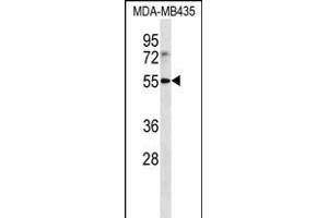 LILRB4 Antibody (N-term) (ABIN656231 and ABIN2845546) western blot analysis in MDA-M cell line lysates (35 μg/lane).