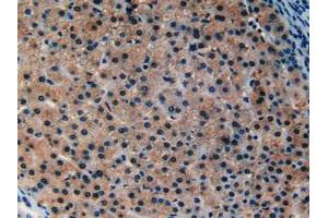 IHC-P analysis of Human Liver Tissue, with DAB staining. (Ataxin 1 抗体  (AA 569-807))