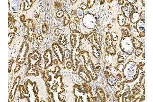 anti-Ubiquitin Specific Peptidase 4 (USP4) antibody