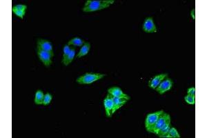 Immunofluorescent analysis of HepG2 cells using ABIN7170295 at dilution of 1:100 and Alexa Fluor 488-congugated AffiniPure Goat Anti-Rabbit IgG(H+L)