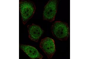 Immunofluorescence (IF) image for anti-Protein Phosphatase 1, Catalytic Subunit, beta Isoform (PPP1CB) (AA 286-315), (C-Term) antibody (ABIN392847)