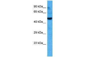 Host:  Mouse  Target Name:  ACVR2B  Sample Tissue:  Mouse Testis  Antibody Dilution:  1ug/ml (ACVR2B 抗体  (Middle Region))