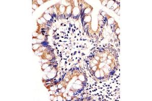 Immunohistochemical analysis of paraffin-embedded H. (CARD6 抗体)