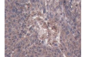 Immunohistochemistry (IHC) image for anti-Colony Stimulating Factor 2 Receptor, Beta (CSF2RB) (AA 133-233) antibody (ABIN7438586)