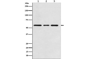 Western blot analysis of ACVRL1 expression in (1) Jurkat cell lysate, (2) Mouse kidney lysate, (3) Rat kidney lysate.