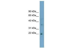 LDLRAD1 antibody used at 1 ug/ml to detect target protein. (LDLRAD1 抗体  (Middle Region))