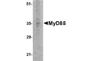Western Blotting (WB) image for anti-Myeloid Differentiation Primary Response Gene (88) (MYD88) (AA 176-280) antibody (ABIN492527) (MYD88 抗体  (AA 176-280))