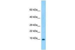 Image no. 1 for anti-S100 Calcium Binding Protein B (S100B) (AA 27-76) antibody (ABIN6748322) (S100B 抗体  (AA 27-76))