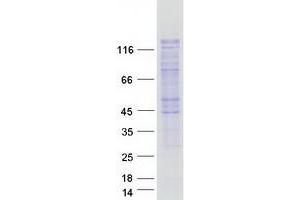 Western Blotting (WB) image for SWI/SNF-Related, Matrix-Associated Actin-Dependent Regulator of Chromatin, Subfamily A, Containing DEAD/H Box 1 (SMARCAD1) (Transcript Variant 3) protein (Myc-DYKDDDDK Tag) (ABIN2732237)