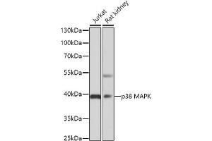 Western blot analysis of extracts of various cell lines, using p38 MAPK antibody (ABIN6130006, ABIN6143525, ABIN6143527 and ABIN6221180) at 1:3000 dilution. (MAPK14 抗体  (AA 1-360))