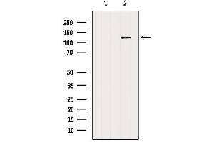 Western blot analysis of extracts from B16F10, using NFAT4 Antibody.