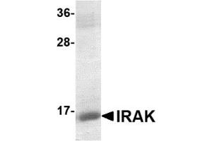 Western Blotting (WB) image for Interleukin-1 Receptor-Associated Kinase 1 (IRAK1) (AA 618-712) protein (His tag) (ABIN2468732) (IRAK1 Protein (AA 618-712) (His tag))