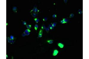 Immunofluorescence (IF) image for anti-Abhydrolase Domain Containing 2 (ABHD2) (AA 31-320) antibody (ABIN7160145)